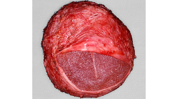 Content Dam Sr Online Articles 2019 05 19may9piaclintipt