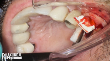 19 Aug8 Pi Aclintip 5d37419ee74be