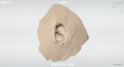 Figure 4: Off-label TRIOS scan used in the fabrication of auricular maxillofacial prosthetics. Figure 4: Off-label TRIOS scan used in the fabrication of auricular maxillofacial prosthetics.