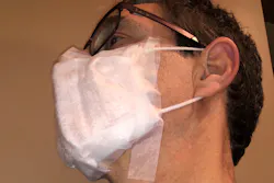 Figure 7b: Inferior lateral view: Add tape as instructed in Figure 7a. Figure 7b: Inferior lateral view: Add tape as instructed in Figure 7a.