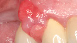 20 Jun11 Pi Aperiotherapy01 5ede90bf4a868 20 Jun11 Pi Aperiotherapy01 5ede90bf4a868