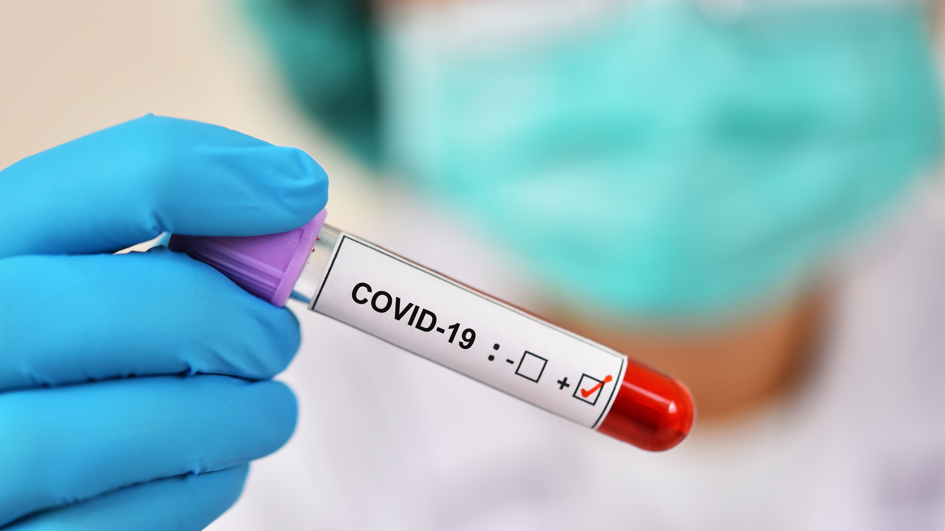 Jarun011 Dreamstime Covid 19 5f32d47884ee3