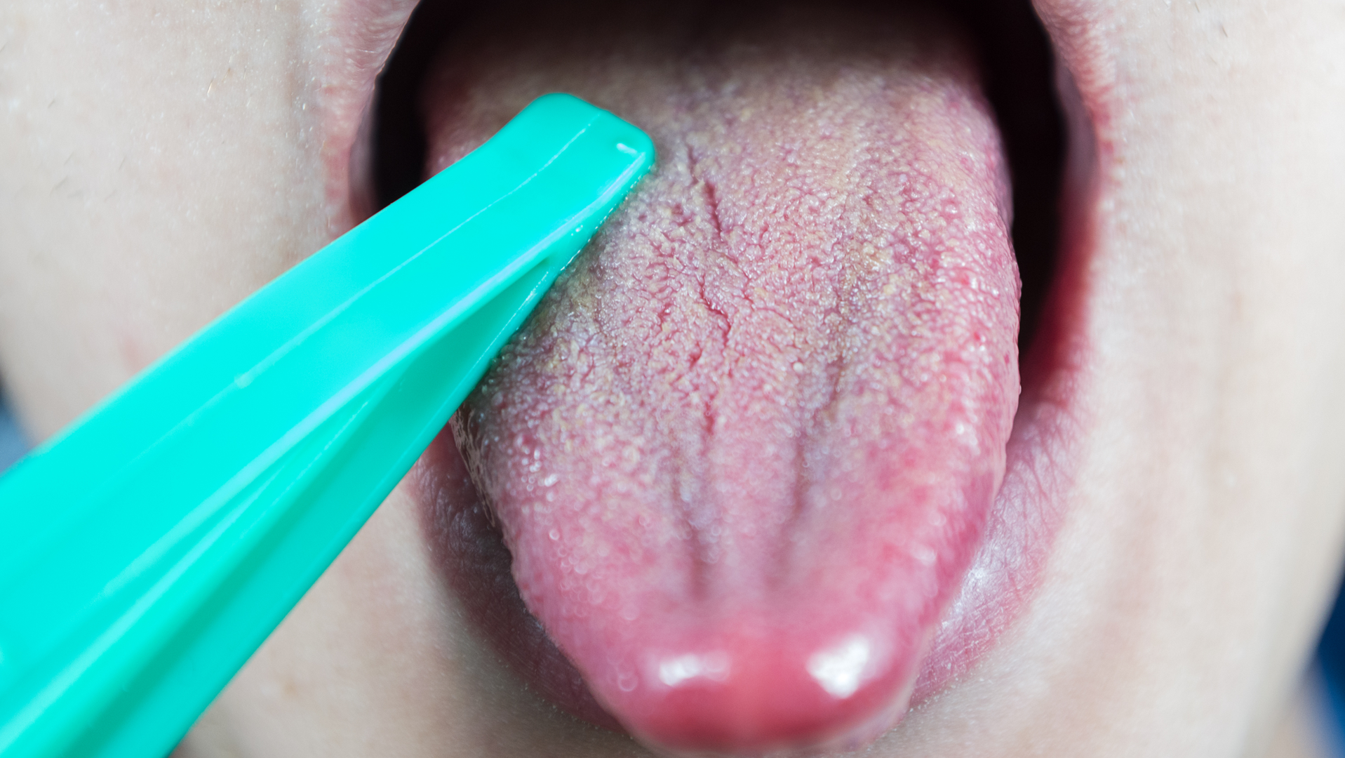 Dreamstime Xl 169530427 5fbe947b45b50