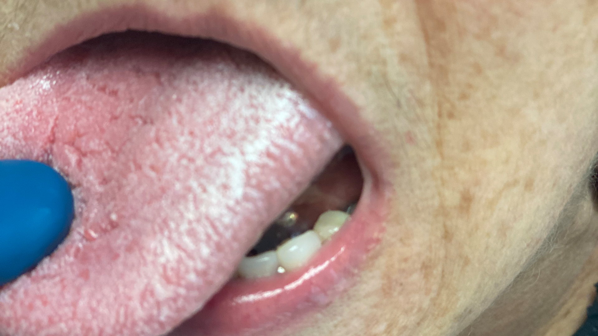 Figure2 Img 4928 Rot