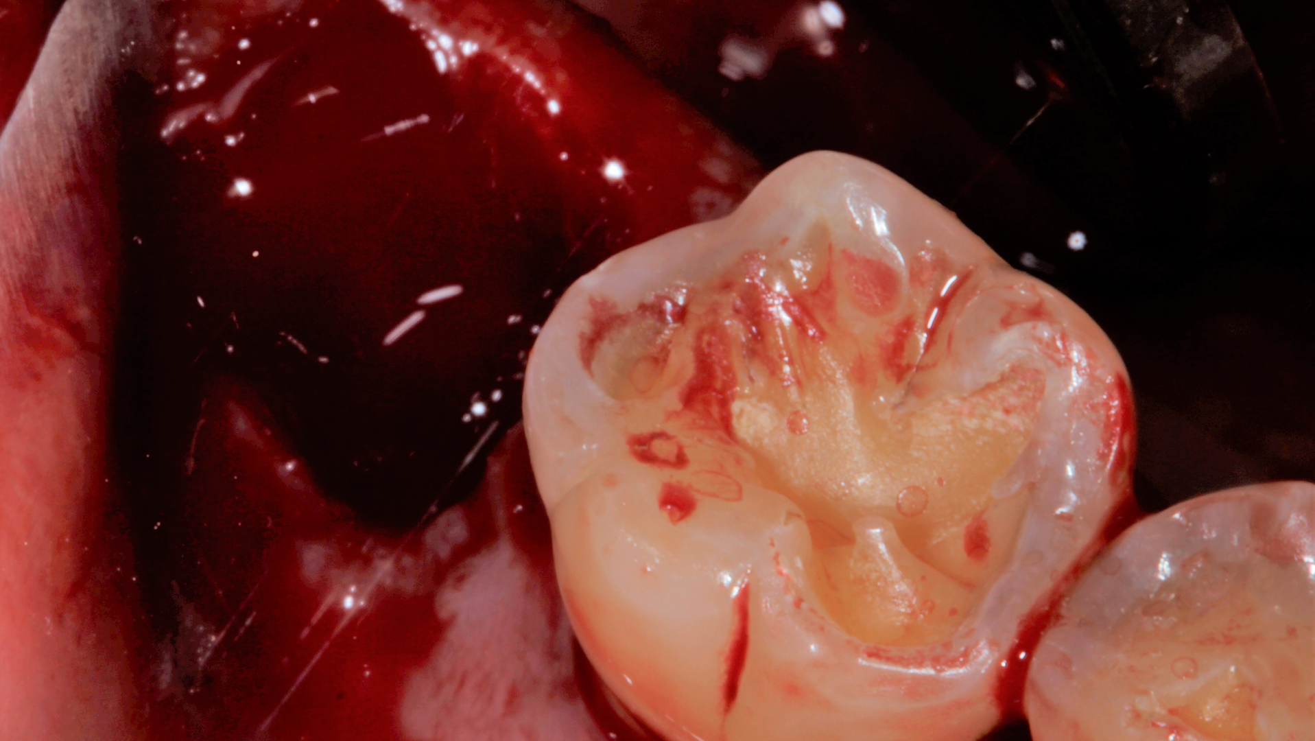 Primary 61a92af209527