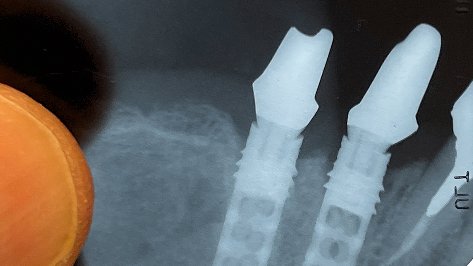 Image2 62797e2876cc9