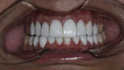 Mg 9695 629e61e93a841 Mg 9695 629e61e93a841