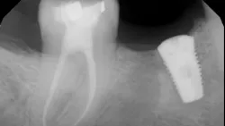 Primary 63e2cf8deabcf Primary 63e2cf8deabcf