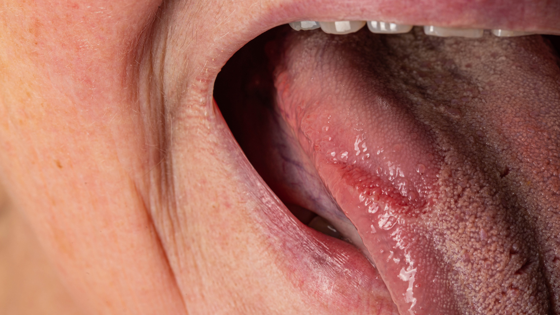 Dreamstime Xxl 254464253