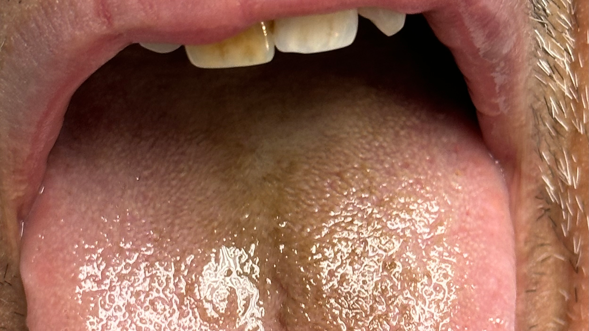 Figure1 6478ff0df1059