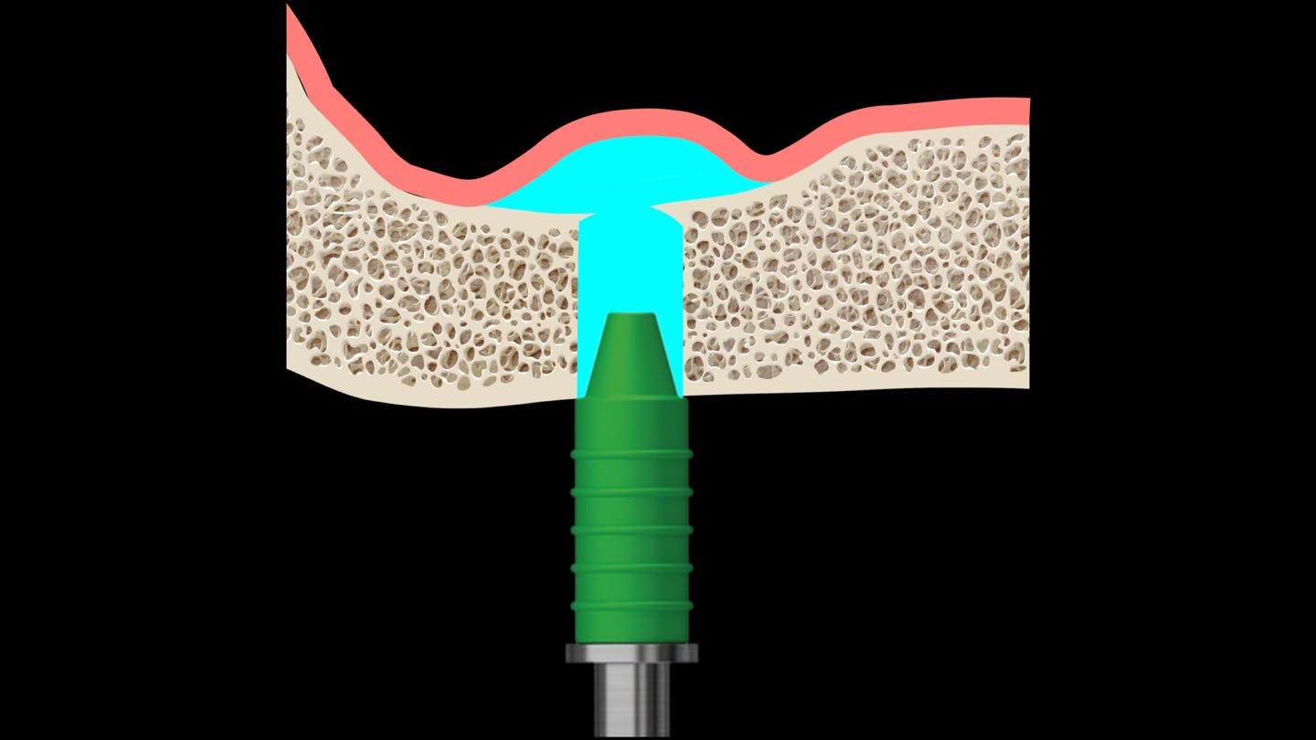 6570e19dbdf3fd001e736400 Primaryhydraulicsinuslift