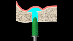 6570e19dbdf3fd001e736400 Primaryhydraulicsinuslift 6570e19dbdf3fd001e736400 Primaryhydraulicsinuslift