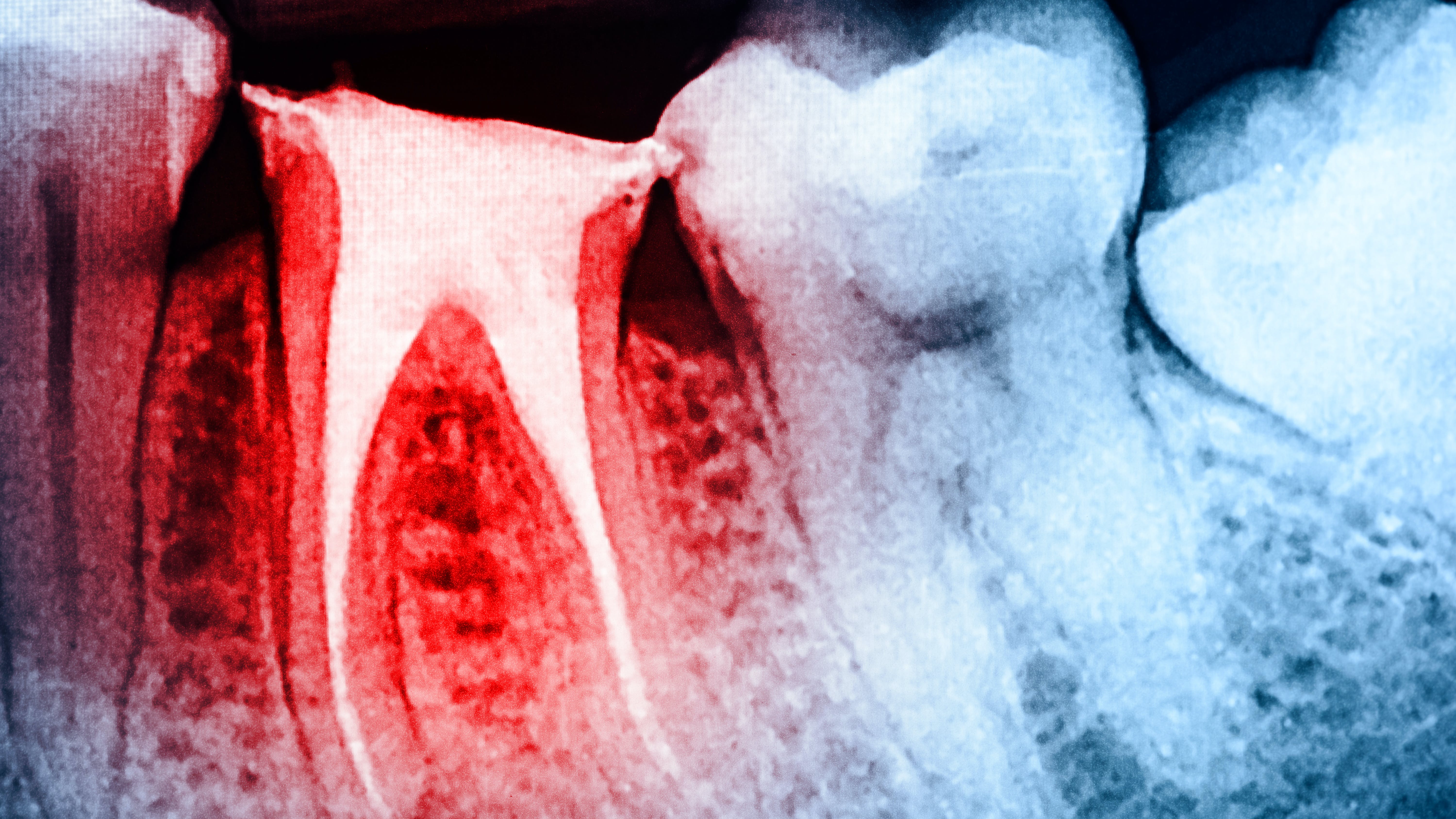 dreamstime_xxl_68560230