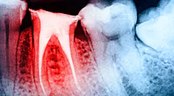 dreamstime_xxl_68560230 dreamstime_xxl_68560230