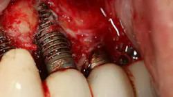 66fec49eb6dc627e60ceeab1 Figure1corrosion 66fec49eb6dc627e60ceeab1 Figure1corrosion