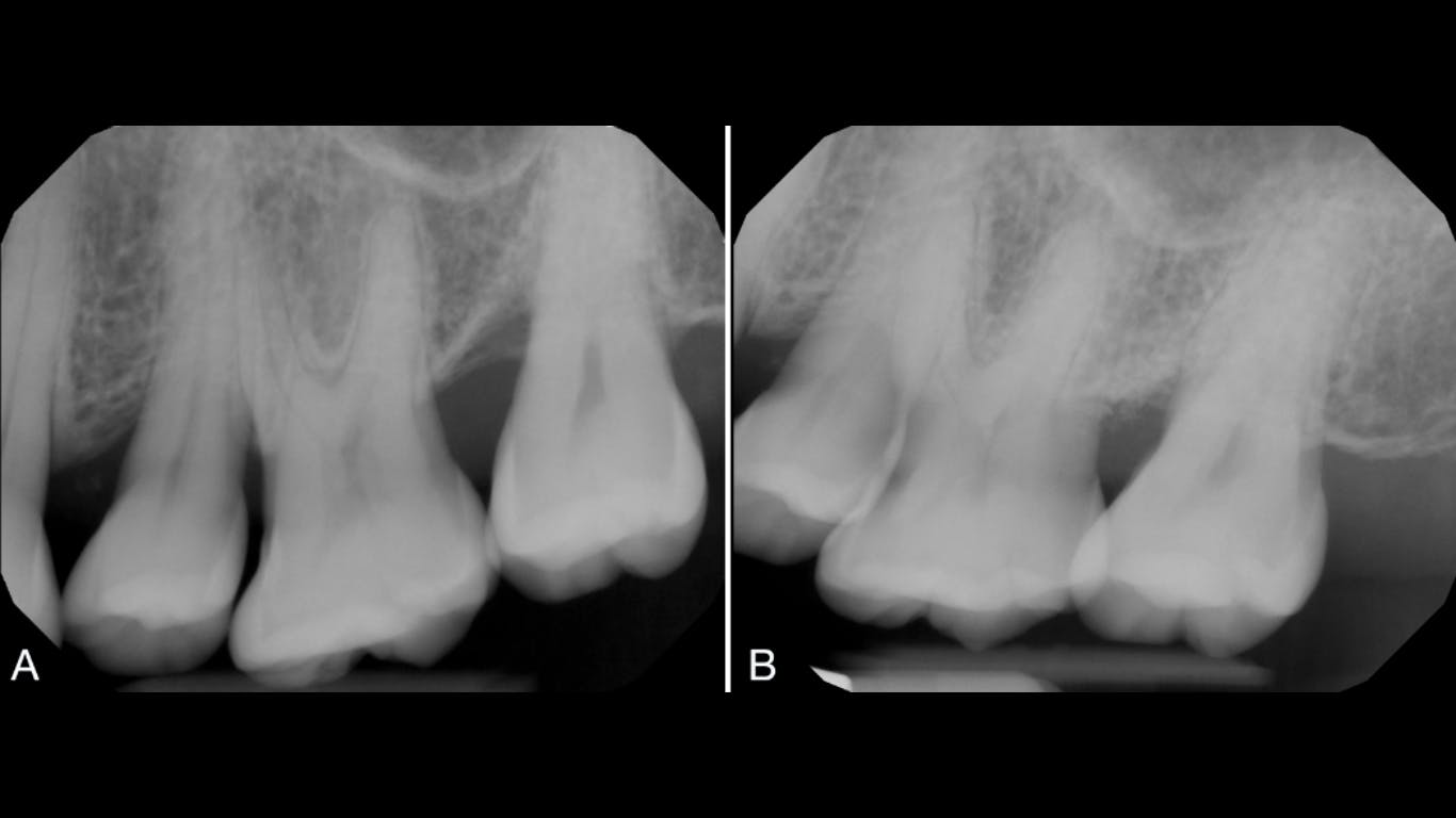 regenerative medicine