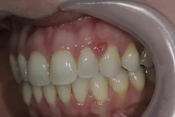 closeup of teeth closeup of teeth