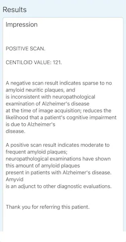 Figure 2: P-tau181 test results Figure 2: P-tau181 test results
