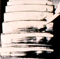 3-87%20tooth%20damage 3-87%20tooth%20damage