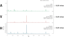 Figure 4. Spectra plotted in A-V-H order on the same amplitude scale. Figure 4. Spectra plotted in A-V-H order on the same amplitude scale.