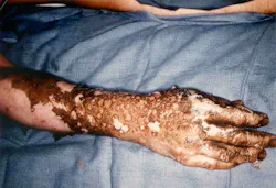 Figure 2. Protecting employees from arc flash injuries is paramount Figure 2. Protecting employees from arc flash injuries is paramount