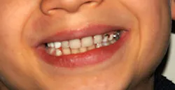 1206rdhcbur1 1206rdhcbur1