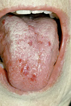 1208rdhcbur2 1208rdhcbur2