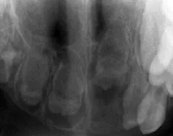 1210rdhcbur2 1210rdhcbur2