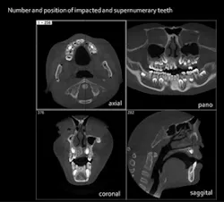 1301rdhfhuy2 1301rdhfhuy2