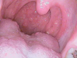 1506rdhcburfigure2 1506rdhcburfigure2