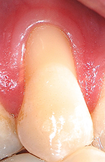 Figure 1 Pm Jd Before