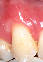Figure 2 Pm Jd After Figure 2 Pm Jd After