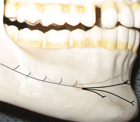 Figure 1 Inc Ment Nvs