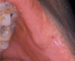 Pennwell web 250 206