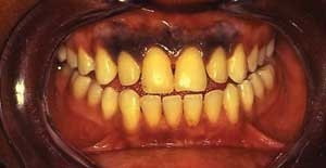 Pennwell web 300 155