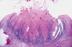 Pennwell web 300 195 Pennwell web 300 195