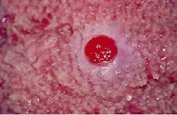 Th 2105rdhcs Th 2105rdhcs