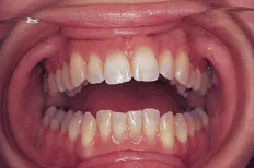 Th Rdh110596 34 Th Rdh110596 34