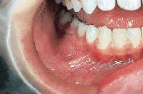 Th Rdh122893 30 Th Rdh122893 30