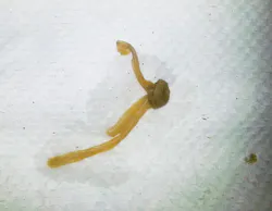 Biofilm From Bottle Waterline Biofilm From Bottle Waterline