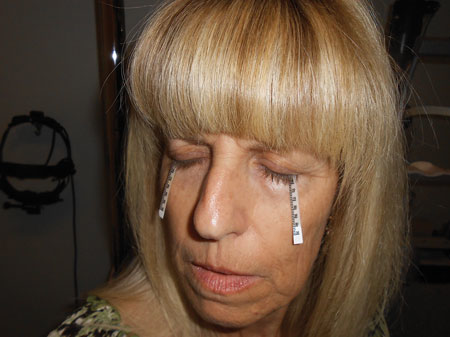 Figure 1: Patient taking the Schirmer Test. The machine to the left of the patient is used for another test called 'Slit Lamp Biomicroscopy' used by ophthalmologists and researchers.