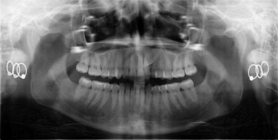 Content Dam Rdh En Articles Slideshows 2014 08 Dental Photo Of The Day 23 Leftcolumn Article Thumbnailimage File