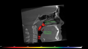 Content Dam Rdh Print Articles Volume 39 Issue 2 1902rdhroy Thumb