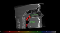 Content Dam Rdh Print Articles Volume 39 Issue 2 1902rdhroy Thumb Content Dam Rdh Print Articles Volume 39 Issue 2 1902rdhroy Thumb