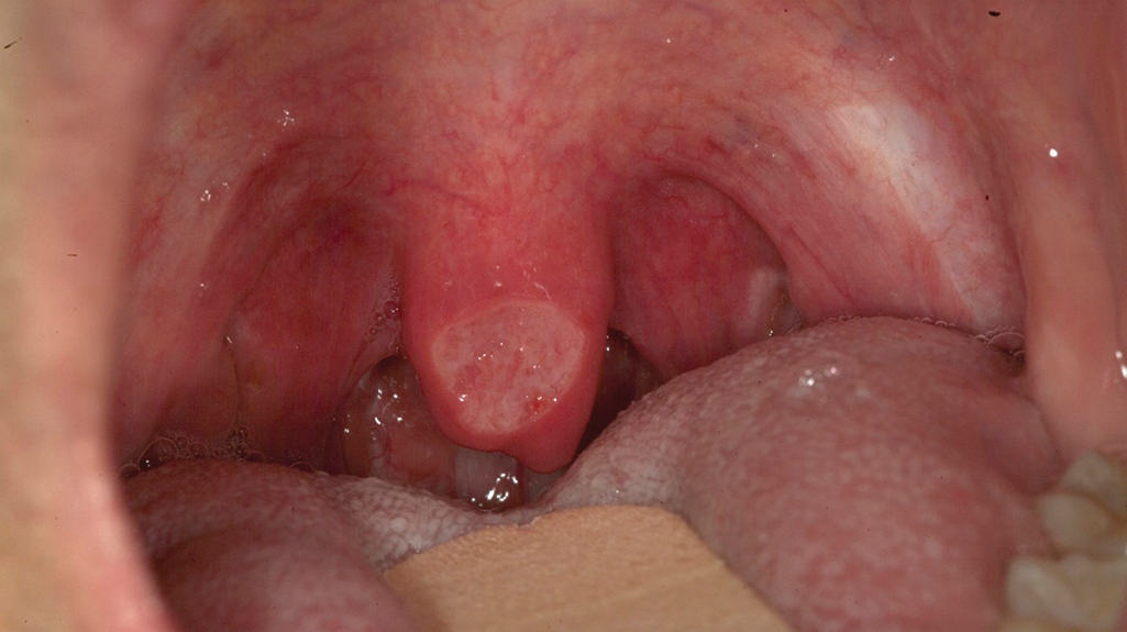 1910 Rd Hbur Thumb 2