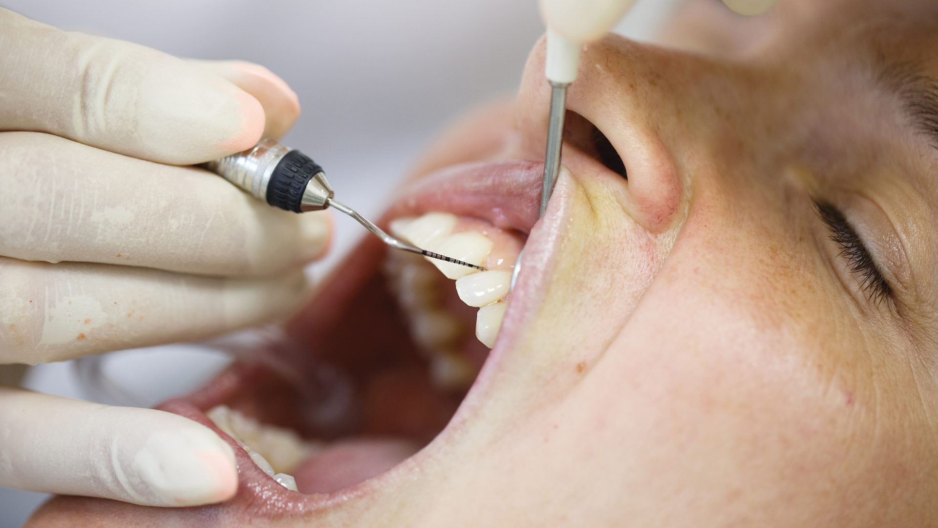 1912 Rd Hwat P01 5dfd07b92bfa1