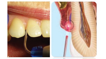 1912 Rd Hdav 16x9 5df1062d26732