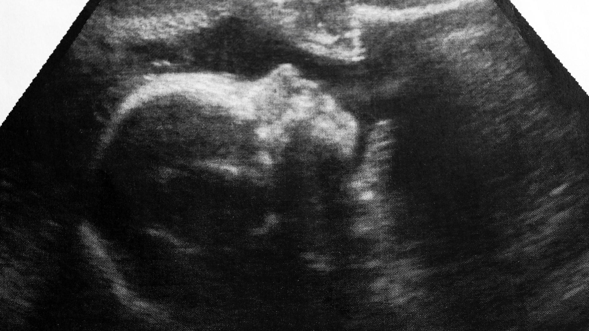 Dreamstime M 142004758 5e4ec8358a58e