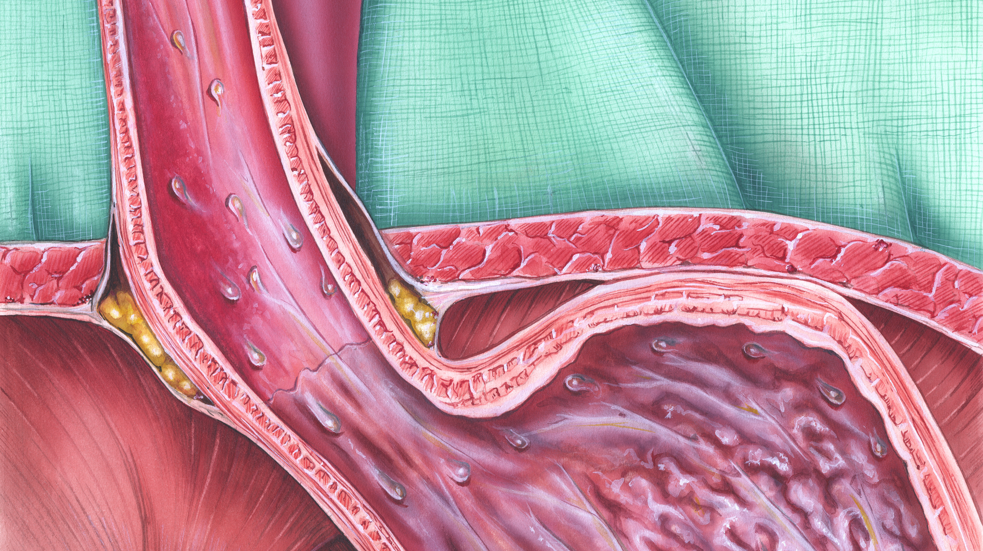 Dreamstime M 60391682 5e5fd63b21952