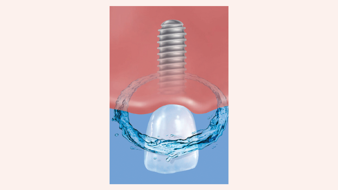 2003 Rd Hwin Thumb 5e6907c0f410a